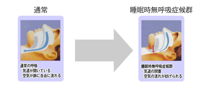 通常の呼吸との比較